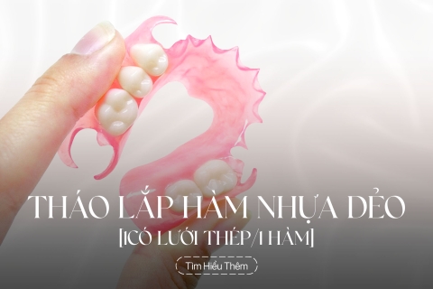 Tháo lắp hàm nhựa dẻo có lưới thép